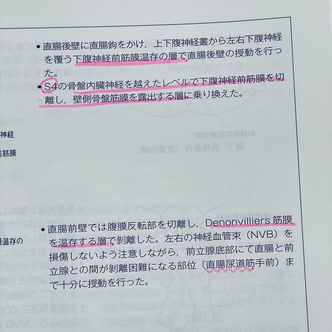 消化器外科　手術記録の書き方 Vol.37 No.5 2014年4月号